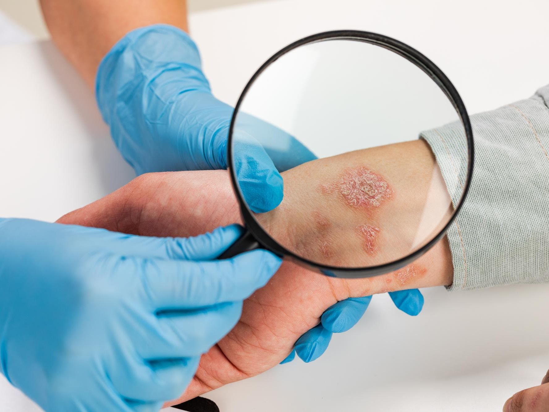 dermatologist-wearing-gloves-examines-skin-sick-patient-examination-diagnosis-skin-diseases-allergies-psoriasis-eczema-dermatitis.jpg